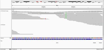 Case Report: Uncommon Association of ITGB4 and KRT10 Gene Mutation in a Case of Epidermolysis Bullosa With Pyloric Atresia and Aplasia Cutis Congenita